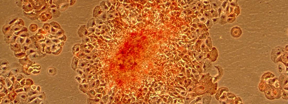 illustration Promising anticancer research using protozoa