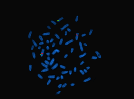 Phot au microscope de chromosomes de vaches montrant des marqueures d'anomalie