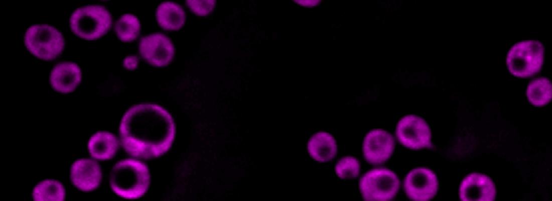 illustration Une nouvelle méthode d’imagerie cellulaire non-invasive révèle la structure des gouttelettes lipidiques 