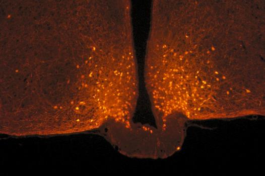 The origin of satiety: brain cells that change shape after a meal