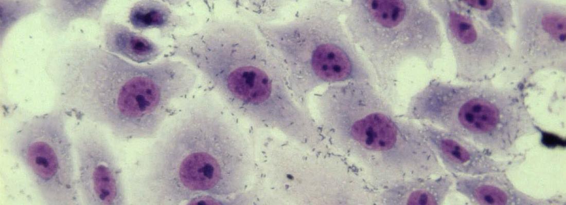 illustration Mic10, un nouveau facteur de cellule hôte impliqué dans Listeria monocytogenes manipulation de la dynamique mitochondriale pendant l'infection
