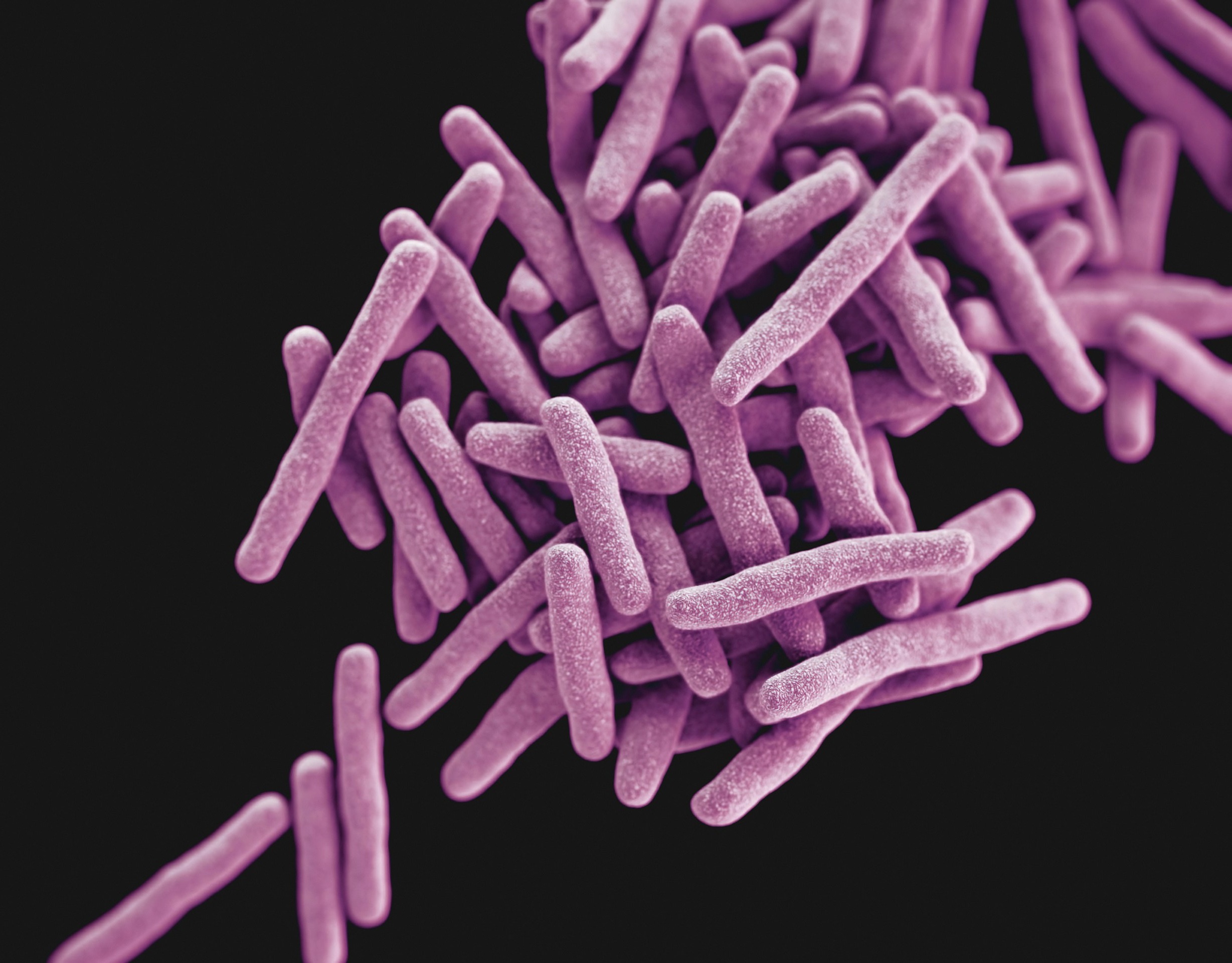 Tuberculosis: towards future biomarkers for assessing infectivity