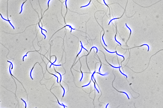 Spermatozoïdes de coq dont le noyau est marqué par fluorescence bleue