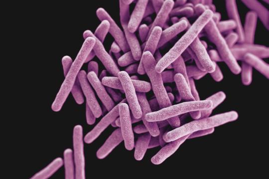 Tuberculose : vers de futurs biomarqueurs  pour évaluer la contagiosité